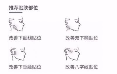 韩国瘦脸贴有用吗，瘦脸贴是否可以用双眼皮贴替代 瘦脸 第2张