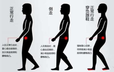 倒走有什么好处和坏处，原来这就是“不走寻常路” 减肥 第1张