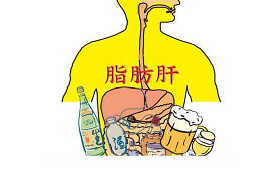 脂肪肝如何治疗(脂肪肝如何治疗吃什么食物) 减肥 第1张