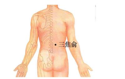 拔罐减肥的位置图，3个部位穴位拔罐减肥 拔罐减肥 第1张